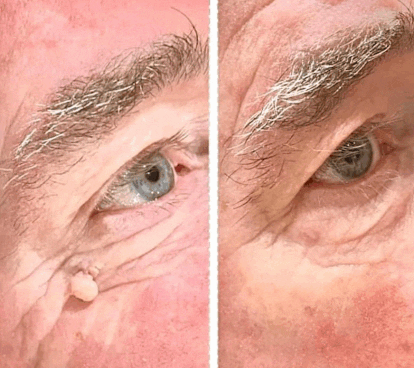 Hands and Feet Treatments